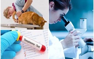   XN 005 GÓI XÉT NGHIỆM GIUN SÁN